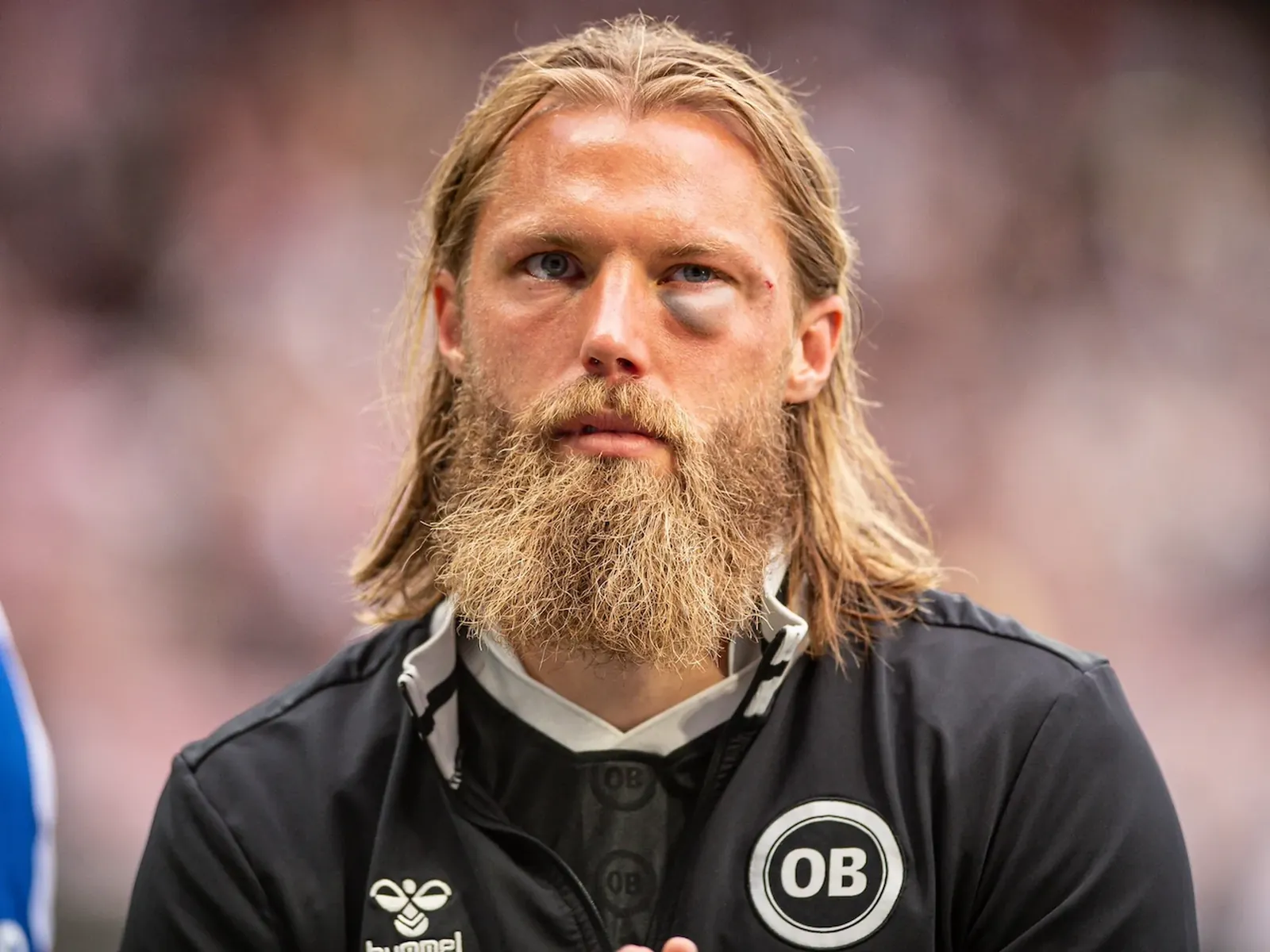 Odense vs Viborg - prediction, team news, lineups